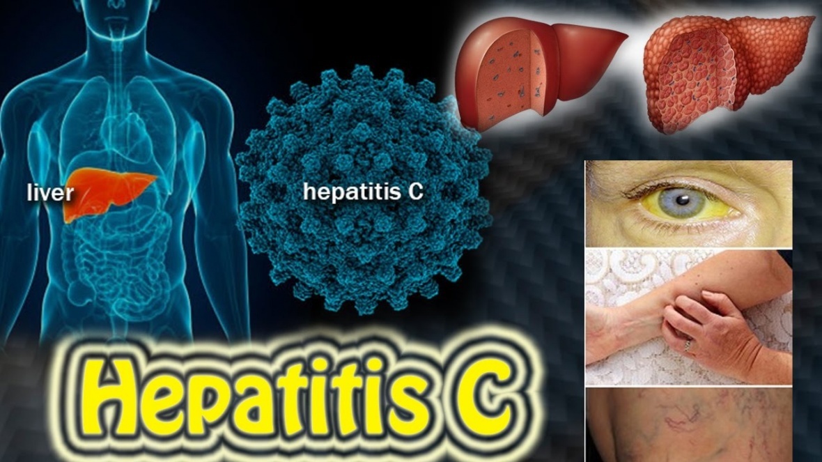 Про гепатит С
